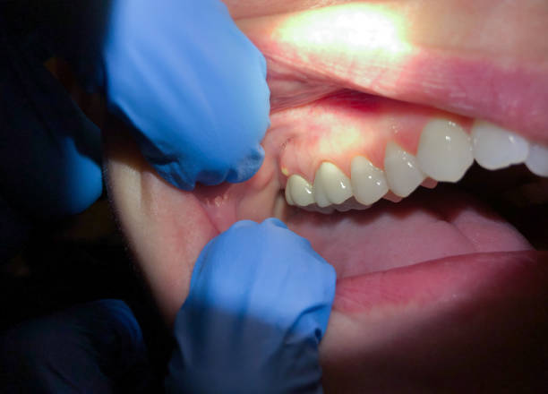 Best Emergency Dental Services Near Me  in Governors Village, NC
