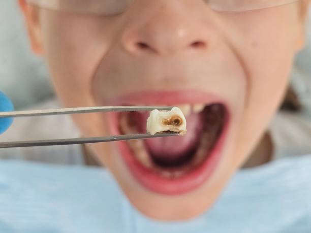 Best Dentist Open Late Near Me  in Governors Village, NC